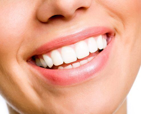 Whitening of individual dark teeth