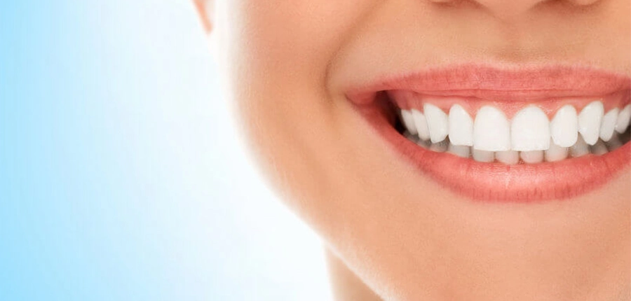 Beautiful bright teeth thanks to aesthetic dentistry at the dentist