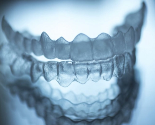 Aligner
