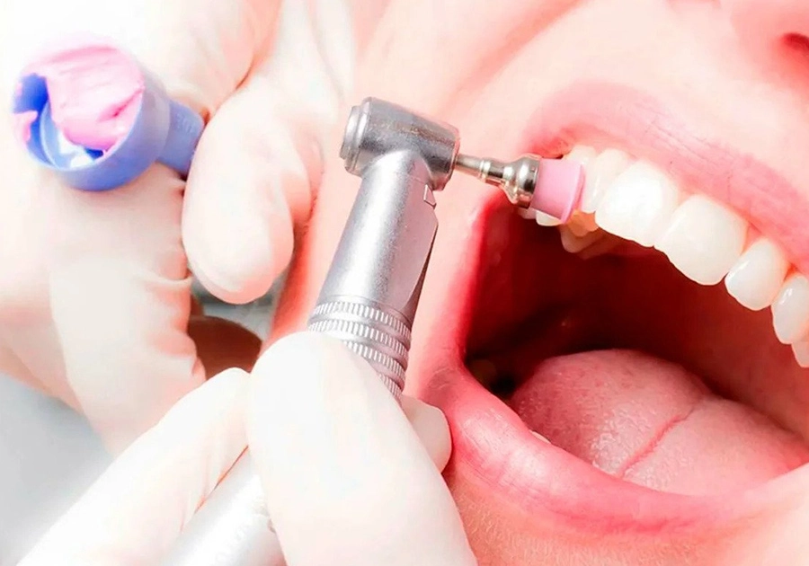 Prophylaxe-Behandlung beim Zahnarzt