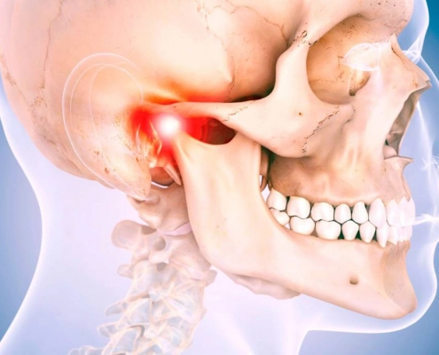 Jaw joint problems / Jaw cracking